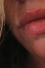 Molly